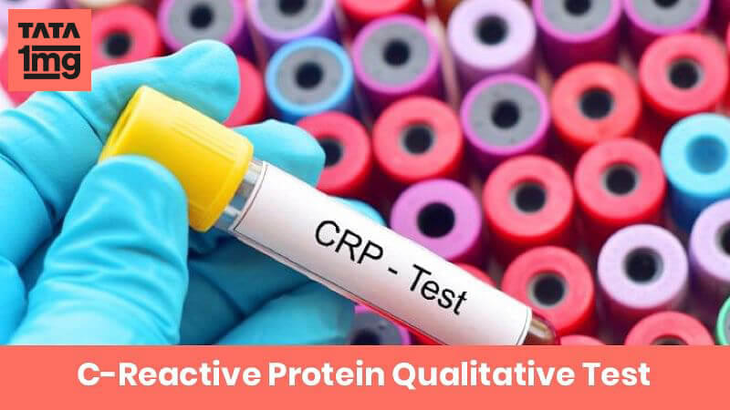 C-Reactive Protein Qualitative